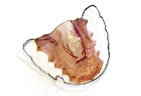 Once your teeth have been repositioned a temporary retain is needed to keep teeth in position Retainers for Orthodontics